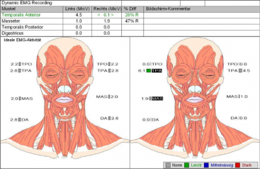 Craniomandibuläre Dysfunktion (CMD):